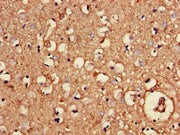 Immunohistochemistry of paraffin-embedded human brain tissue using CSB-PA016070LA01HU at dilution of 1:100