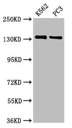 Western Blot Positive WB detected in: K562 whole cell lysate, PC-3 whole cell lysate All lanes: NRDC antibody at 3.73µg/ml Secondary Goat polyclonal to rabbit IgG at 1/50000 dilution Predicted band size: 132, 140 kDa Observed band size: 132 kDa