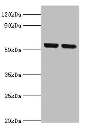 Western blot All lanes: Nuclear respiratory factor 1 antibody at 3ug/ml Lane 1: Mouse skeletal muscle tissue Lane 2: MCF-7 whole cell lysate Secondary Goat polyclonal to rabbit IgG at 1/10000 dilution Predicted band size: 54, 47, 37, 56 kDa Observ...
