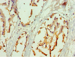 Immunohistochemistry of paraffin-embedded human prostate tissue using CSB-PA016076ESR2HU at dilution of 1:100