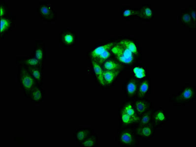 Immunofluorescence staining of HepG2 cells with CSB-PA016086LA01HU at 1:33, counter-stained with DAPI. The cells were fixed in 4% formaldehyde, permeabilized using 0.2% Triton X-100 and blocked in 10% normal Goat Serum. The cells were then incubat...