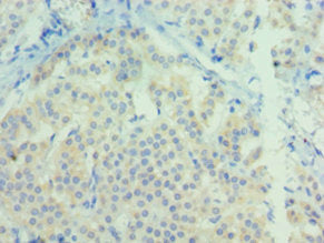 Immunohistochemistry of paraffin-embedded human adrenal gland tissue using CSB-PA016120ESR2HU at dilution of 1:100