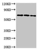 Western Blot Positive WB detected in: 293T whole cell lysate, Hela whole cell lysate, HepG2 whole cell lysate All lanes: NTN1 antibody at 6.4µg/ml Secondary Goat polyclonal to rabbit IgG at 1/50000 dilution Predicted band size: 68 kDa Observed ban...