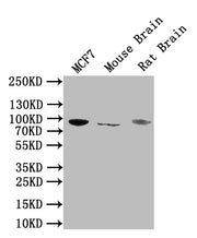 Western Blot Positive WB detected in: MCF7 whole cell lysate, Mouse Brain tissue lysate, Rat Brain tissue lysate All lanes: NTRK1 antibody at 1:1000 Secondary Goat polyclonal to rabbit IgG at 1/50000 dilution Predicted band size: 88, 87, 84, 78 kD...