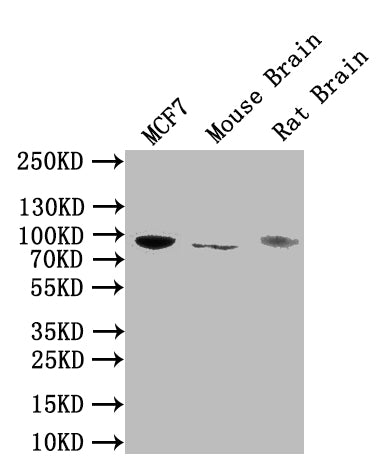 Western Blot Positive WB detected in: MCF7 whole cell lysate, Mouse Brain tissue lysate, Rat Brain tissue lysate All lanes: NTRK1 antibody at 1:1000 Secondary Goat polyclonal to rabbit IgG at 1/50000 dilution Predicted band size: 88, 87, 84, 78 kD...
