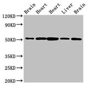 Western Blot Positive WB detected in: Rat brain tissue, Rat heart tissue, Mouse heart tissue, Mouse liver tissue, Mouse brain tissue All lanes: NUCB2 antibody at 2.5ug/ml Secondary Goat polyclonal to rabbit IgG at 1/50000 dilution Predicted band s...