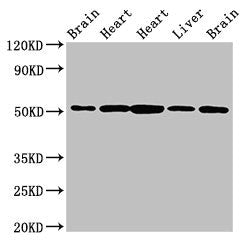 Western Blot Positive WB detected in: Rat brain tissue, Rat heart tissue, Mouse heart tissue, Mouse liver tissue, Mouse brain tissue All lanes: NUCB2 antibody at 2.5ug/ml Secondary Goat polyclonal to rabbit IgG at 1/50000 dilution Predicted band s...