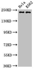Western Blot Positive WB detected in: Hela whole cell lysate, K562 whole cell lysate All lanes: NUMA1 antibody at 3.2µg/ml Secondary Goat polyclonal to rabbit IgG at 1/50000 dilution Predicted band size: 239, 237, 202, 201, 110 kDa Observed band s...