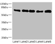 Western blot All lanes: NUMB antibody at 0.93µg/ml Lane 1: Mouse brain tissue Lane 2: A431 whole cell lysate Lane 3: HepG2 whole cell lysate Lane 4: Hela whole cell lysate Lane 5: Mouse kidney tissue Secondary Goat polyclonal to rabbit IgG at 1/10...