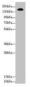 Western blot All lanes: NUP155 antibody at 3.47µg/ml + Hela whole cell lysate Secondary Goat polyclonal to rabbit IgG at 1/10000 dilution Predicted band size: 156, 150 kDa Observed band size: 156 kDa