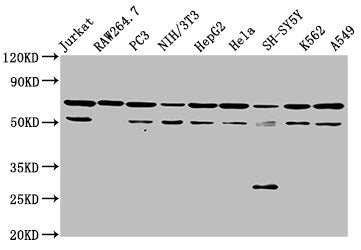 Western Blot Positive WB detected in: Jurkat whole cell lysate, RAW264.7 whole cell lysate, PC-3 whole cell lysate, NIH/3T3 whole cell lysate, HepG2 whole cell lysate, Hela whole cell lysate, SH-SY5Y whole cell lysate, K562 whole cell lysate, A549...