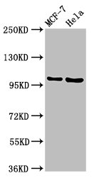 Western Blot Positive WB detected in: MCF-7 whole cell lysate, Hela whole cell lysate All lanes: NUP98 antibody at 3.2ug/ml Secondary Goat polyclonal to rabbit IgG at 1/50000 dilution Predicted band size: 198, 188, 98, 97, 196, 187 kDa Observed ba...