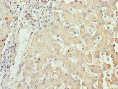 Immunohistochemistry of paraffin-embedded human liver tissue using CSB-PA016211LA01HU at dilution of 1:100