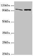 Western blot All lanes: NVL antibody at 10ug/ml Lane 1: Mouse thymus tissue Lane 2: Hela whole cell lysate Secondary Goat polyclonal to rabbit IgG at 1/10000 dilution Predicted band size: 96, 83, 73, 74, 86 kDa Observed band size: 96 kDa