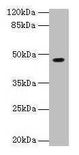 Western blot All lanes: NXF5 antibody at 4µg/ml + HL60 whole cell lysate Secondary Goat polyclonal to rabbit IgG at 1/10000 dilution Predicted band size: 46, 43, 20, 36, 35 kDa Observed band size: 46 kDa