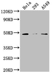 Western Blot Positive WB detected in: Hela whole cell lysate, 293 whole cell lysate, A549 whole cell lysate All lanes: NXN antibody at 1:2000 Secondary Goat polyclonal to rabbit IgG at 1/50000 dilution Predicted band size: 49, 21, 37 kDa Observed...