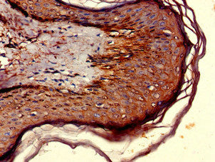 Immunohistochemistry of paraffin-embedded human skin tissue using CSB-PA016227LA01HU at dilution of 1:100