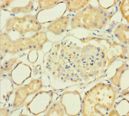 Immunohistochemistry of paraffin-embedded human kidney tissue using CSB-PA016228LA01HU at dilution of 1:100