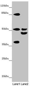 Western blot All lanes: NYX antibody at 7.23 ug/ml Lane 1: Mouse gonadal tissue Lane 2: Mouse liver tissue Secondary Goat polyclonal to rabbit IgG at 1/10000 dilution Predicted band size: 52 kDa Observed band size: 52, 37, 45, 90 kDa