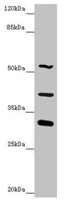 Western blot All lanes: NYX antibody at 4.91 ug/ml + Mouse liver tissue Secondary Goat polyclonal to rabbit IgG at 1/10000 dilution Predicted band size: 52 kDa Observed band size: 52, 32, 39 kDa