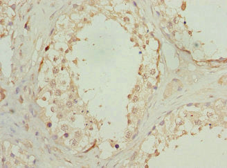 Immunohistochemistry of paraffin-embedded human testis tissue using CSB-PA016245DSR1HU at dilution of 1:100