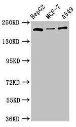 Western Blot Positive WB detected in: HepG2 whole cell lysate, MCF-7 whole cell lysate, A549 whole cell lysate, All lanes: OBSL1 antibody at 2.5ug/ml Secondary Goat polyclonal to rabbit IgG at 1/50000 dilution Predicted band size: 207 kDa Observed...