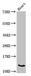 Western Blot Positive WB detected in: Mouse heart tissue All lanes: Ocm antibody at 3µg/ml Secondary Goat polyclonal to rabbit IgG at 1/50000 dilution Predicted band size: 13 kDa Observed band size: 13 kDa