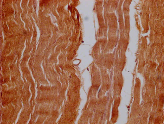 IHC image of CSB-PA016289LA01HU diluted at 1:100 and staining in paraffin-embedded human skeletal muscle tissue performed on a Leica BondTM system. After dewaxing and hydration, antigen retrieval was mediated by high pressure in a citrate buffer (...