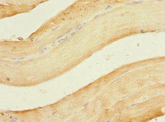 Immunohistochemistry of paraffin-embedded human skeletal muscle tissue using CSB-PA016311ESR2HU at dilution of 1:100