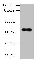 Western blot All lanes: OGG1 antibody at 6µg/ml + Hela whole cell lysate Secondary Goat polyclonal to rabbit IgG at 1/10000 dilution Predicted band size: 39, 37, 46, 48, 40, 23, 41 kDa Observed band size: 39 kDa