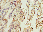 Immunohistochemistry of paraffin-embedded human lung tissue using CSB-PA016314ESR1HU at dilution of 1:100