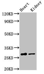 Western Blot Positive WB detected in: Rat heart tissue, Rat kidney tissue All lanes: OLIG1 antibody at 3.2ug/ml Secondary Goat polyclonal to rabbit IgG at 1/50000 dilution Predicted band size: 28 kDa Observed band size: 28 kDa