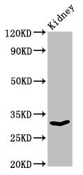 Western Blot Positive WB detected in: Rat kidney tissue All lanes: OLR1 antibody at 3µg/ml Secondary Goat polyclonal to rabbit IgG at 1/50000 dilution Predicted band size: 31, 21, 22 kDa Observed band size: 31 kDa