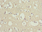 Immunohistochemistry of paraffin-embedded human brain tissue using CSB-PA016334ESR2HU at dilution of 1:100