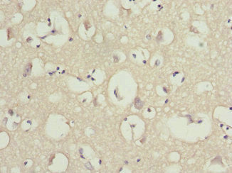 Immunohistochemistry of paraffin-embedded human brain tissue using CSB-PA016334ESR2HU at dilution of 1:100