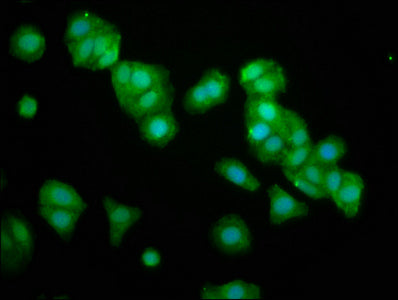 Immunofluorescence staining of HepG2 cells with CSB-PA016335LA01HU at 1:133, counter-stained with DAPI. The cells were fixed in 4% formaldehyde, permeabilized using 0.2% Triton X-100 and blocked in 10% normal Goat Serum. The cells were then incuba...