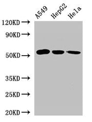 Western Blot Positive WB detected in: A549 whole cell lysate, HepG2 whole cell lysate, Hela whole cell lysate All lanes: ONECUT2 antibody at 2.4µg/ml Secondary Goat polyclonal to rabbit IgG at 1/50000 dilution Predicted band size: 55 kDa Observed...