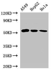 Western Blot Positive WB detected in: A549 whole cell lysate, HepG2 whole cell lysate, Hela whole cell lysate All lanes: ONECUT2 antibody at 2.4µg/ml Secondary Goat polyclonal to rabbit IgG at 1/50000 dilution Predicted band size: 55 kDa Observed...