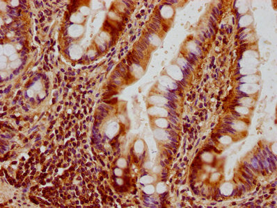 IHC image of CSB-PA016340HA01HU diluted at 1:300 and staining in paraffin-embedded human small intestine tissue performed on a Leica BondTM system. After dewaxing and hydration, antigen retrieval was mediated by high pressure in a citrate buffer (...
