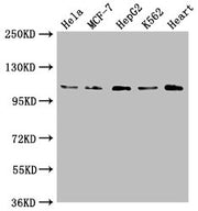 Western Blot Positive WB detected in: Hela whole cell lysate, MCF-7 whole cell lysate, HepG2 whole cell lysate, K562 whole cell lysate, Mouse heart tissue All lanes: OPA1 antibody at 1:2000 Secondary Goat polyclonal to rabbit IgG at 1/50000 diluti...
