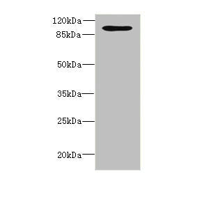 Western blot All lanes: OPHN1 antibody at 1.87ug/ml + A549 whole cell lysate Secondary Goat polyclonal to rabbit IgG at 1/10000 dilution Predicted band size: 92, 37 kDa Observed band size: 92 kDa