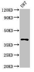 Western Blot Positive WB detected in: U87 whole cell lysate All lanes: OPN1SW antibody at 3ug/ml Secondary Goat polyclonal to rabbit IgG at 1/50000 dilution Predicted band size: 40 kDa Observed band size: 40 kDa