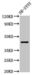 Western Blot Positive WB detected in: SH-SY5Y whole cell lysate All lanes: OPRM1 antibody at 2.9µg/ml Secondary Goat polyclonal to rabbit IgG at 1/50000 dilution Predicted band size: 45, 44, 50, 48, 46, 56, 35, 37, 34, 14, 11, 21 kDa Observed band...