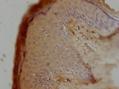 IHC image of CSB-PA016362LA01HU diluted at 1:100 and staining in paraffin-embedded human skin tissue performed on a Leica BondTM system. After dewaxing and hydration, antigen retrieval was mediated by high pressure in a citrate buffer (pH 6.0). Se...
