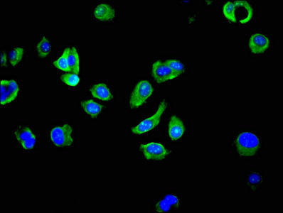 Immunofluorescent analysis of MCF-7 cells using CSB-PA01639A0Rb at dilution of 1:100 and Alexa Fluor 488-congugated AffiniPure Goat Anti-Rabbit IgG(H+L)