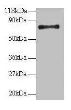 Western blot All lanes: RPS18 antibody at 2µg/ml + 293T whole cell lysate Secondary Goat polyclonal to rabbit IgG at 1/15000 dilution Predicted band size: 18 kDa Observed band size: 75 kDa