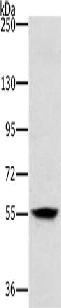 Gel: 6%SDS-PAGE, Lysate: 40 ug, Lane: Mouse skin tissue, Primary antibody: CSB-PA016566(LOXL1 Antibody) at dilution 1/200, Secondary antibody: Goat anti rabbit IgG at 1/8000 dilution, Exposure time: 5 minutes