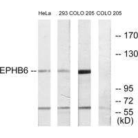 Western blot analysis of extracts from HeLa cells, 293 cells and COLO cells, using EPHB6 antibody.