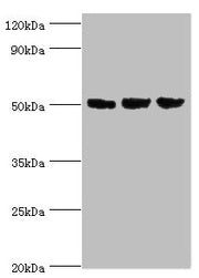 Western blot All lanes: ORC4 antibody at 4µg/ml Lane 1: Hela whole cell lysate Lane 2: Jurkat whole cell lysate Lane 3: A549 whole cell lysate Secondary Goat polyclonal to rabbit IgG at 1/10000 dilution Predicted band size: 51, 41, 43 kDa Observed...