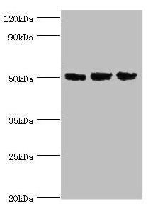 Western blot All lanes: ORC4 antibody at 4µg/ml Lane 1: Hela whole cell lysate Lane 2: Jurkat whole cell lysate Lane 3: A549 whole cell lysate Secondary Goat polyclonal to rabbit IgG at 1/10000 dilution Predicted band size: 51, 41, 43 kDa Observed...